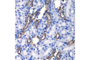 Immunohistochemistry of paraffin-embedded rat kidney using MATK antibody. (MATK anticorps)