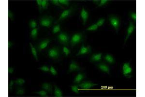Immunofluorescence of monoclonal antibody to MAPK3 on HeLa cell. (ERK1 anticorps  (AA 279-379))