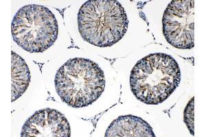 IHC analysis of FMN1 using anti-FMN1 antibody . (FMN1 anticorps  (AA 1195-1419))