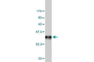 Western Blot detection against Immunogen (36. (FHIT anticorps  (AA 31-130))