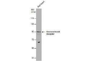 WB Image Glucocorticoid receptor antibody detects Glucocorticoid receptor protein by western blot analysis. (Glucocorticoid Receptor anticorps  (N-Term))