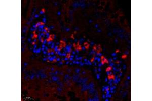 Immunofluorescence of paraffin embedded rat small intestine using DCR3 (ABIN7076071) at dilution of 1: 700 (450x lens)