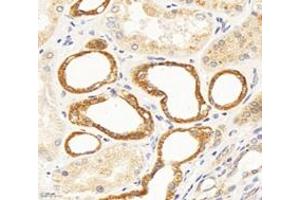 Immunohistochemistry analysis of paraffin-embedded human kidney using,CFA (ABIN7076044) at dilution of 1: 300 (TBCA anticorps)