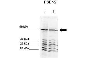 WB Suggested Anti-PSEN2 Antibody    Positive Control:  Lane 1: 80ug rat brain extract Lane 2: 80ug mouse brain extract  Primary Antibody Dilution :   1:500  Secondary Antibody :  IRDye 800 CW goat anti-rabbit from Li-COR Bioscience  Secondry Antibody Dilution :   1:20,000  Submitted by:  Dr. (Presenilin 2 anticorps  (N-Term))