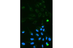 Immunofluorescence analysis of MCF7 cell using UGT1A9 antibody. (UGT1A9 anticorps)