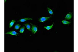 Immunofluorescent analysis of A549 cells using ABIN7150570 at dilution of 1:100 and Alexa Fluor 488-congugated AffiniPure Goat Anti-Rabbit IgG(H+L)