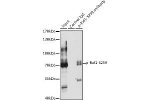 Immunoprecipitation analysis of 200 μg extracts of HeLa cells, using 3 μg Phospho-Raf1-S259 pAb (ABIN6135300, ABIN6136222, ABIN6136223 and ABIN6225538).