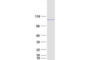 Validation with Western Blot