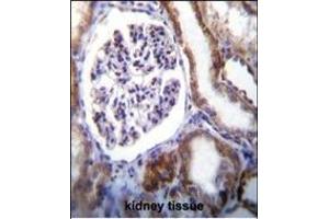 IFT88 Antibody (C-term) (ABIN655090 and ABIN2844723) immunohistochemistry analysis in formalin fixed and paraffin embedded human kidney tissue followed by peroxidase conjugation of the secondary antibody and DAB staining. (IFT88 anticorps  (C-Term))
