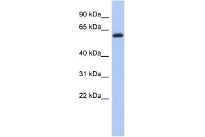WB Suggested Anti-KLHL7 Antibody Titration: 0. (KLHL7 anticorps  (Middle Region))