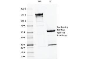 SDS-PAGE Analysis of Purified, BSA-Free PTH Antibody (clone PTH/1175). (PTH anticorps  (AA 32-115))