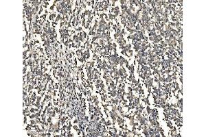 IHC analysis of ATG9A using anti-ATG9A antibody (ABIN7600676). (ATG9A anticorps  (AA 22-169))