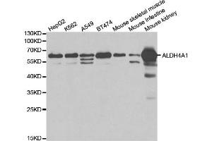 Western blot analysis of extracts of various cell lines, using ALDH4A1 antibody (ABIN5971417) at 1/1000 dilution. (ALDH4A1 anticorps)