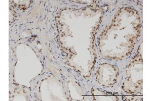 Immunoperoxidase of monoclonal antibody to MED6 on formalin-fixed paraffin-embedded human prostate.