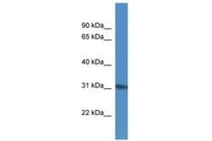 Image no. 1 for anti-Kinesin Family Member 25 (KIF25) (AA 57-106) antibody (ABIN6746071) (KIF25 anticorps  (AA 57-106))