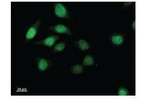 Immunostaining analysis in HeLa cells.