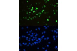 IF analysis of HnRNPF using anti-HnRNPF antibody (ABIN4886622). (HNRNPF anticorps  (N-Term))