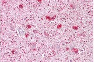 Immunohistochemistry with Brain, cortex tissue at an antibody concentration of 5µg/ml using anti-MCM3 antibody (ARP36644_P050)