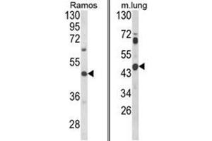 (LEFT) Western blot analysis of CXCR7 Antibody (C-term) in Ramos cell line lysates (35ug/lane). (CXCR7 anticorps  (C-Term))