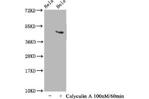 Western Blot Positive WB detected in Hela whole cell lysate(treated with Calyculin A or not) All lanes Phospho-MAPT antibody at 1. (Recombinant MAPT anticorps  (pThr231))