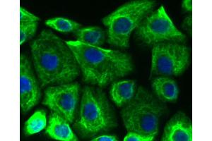 AGS cells were fixed in paraformaldehyde, permeabilized with 0.