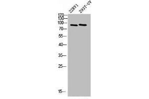 Western Blot analysis of 293T-UV 22RV1 cells using PML Polyclonal Antibody (PML anticorps  (N-Term))