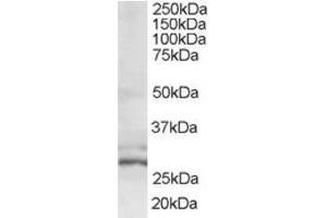 Western Blotting (WB) image for anti-HIV-1 Tat Interactive Protein 2, 30kDa (HTATIP2) (N-Term) antibody (ABIN2466379) (HIV-1 Tat Interactive Protein 2, 30kDa (HTATIP2) (N-Term) anticorps)