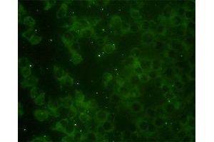 Image no. 3 for anti-RAP2B, Member of RAS Oncogene Family (RAP2B) (AA 1-184) antibody (ABIN598571) (RAP2B anticorps  (AA 1-184))