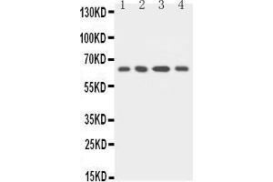 Anti-uPA Receptor antibody, Western blotting Lane 1: MCF-7 Cell Lysate Lane 2: HELA Cell Lysate Lane 3: RAJI Cell Lysate Lane 4: SMMC Cell Lysate (PLAUR anticorps  (C-Term))