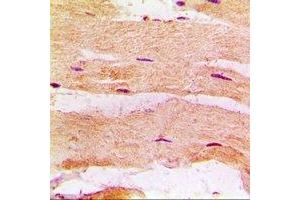 Immunohistochemical analysis of MBNL1 staining in rat heart formalin fixed paraffin embedded tissue section. (MBNL1 anticorps)