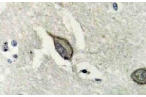 Immunohistochemistry (IHC) analyzes of EphB6 antibody in paraffin-embedded human brain tissue. (EPH Receptor B6 anticorps)