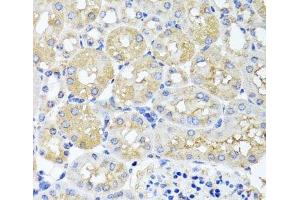 Immunohistochemistry of paraffin-embedded Mouse kidney using HARS2 Polyclonal Antibody at dilution of 1:100 (40x lens). (HARS2 anticorps)