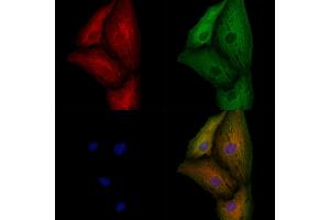 ABIN7094677 and ABIN7098728 staining  cells by IF/ICC.