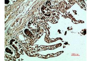 Immunohistochemical analysis of paraffin-embedded human-colon, antibody was diluted at 1:200 (Fibronectin 1 anticorps  (AA 1268-1341))