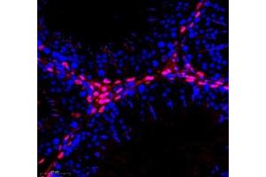 Immunofluorescence of paraffin embedded rat testis using Transketolase (ABIN7075978) at dilution of 1: 1100 (300x lens)
