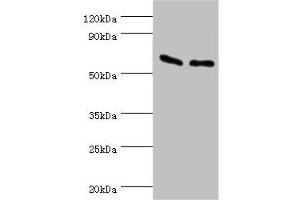 Western blot All lanes: ATP synthase subunit beta, mitochondrial antibody at 9 μg/mL Lane 1: Hela whole cell lysate Lane 2: HepG2 whole cell lysate Secondary Goat polyclonal to rabbit IgG at 1/10000 dilution Predicted band size: 57 kDa Observed band size: 57 kDa (ATP5B anticorps  (AA 230-529))