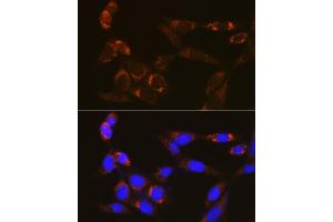 Immunofluorescence analysis of NIH/3T3 cells using PDE4A Rabbit pAb (ABIN7269302) at dilution of 1:100 (40x lens). (PDE4A anticorps)