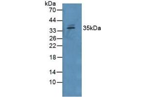 Rabbit Capture antibody from the kit in WB with Positive Control: Human Serum. (GDF15 Kit CLIA)
