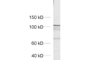 dilution: 1 : 500, sample: crude synaptosomal fraction of rat brain (P2) (ERC2 anticorps  (AA 655-670))