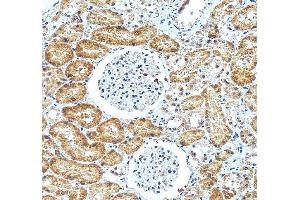 IHC analysis of ATF6 using anti-ATF6 antibody (ABIN7602466). (ATF6 anticorps  (AA 79-670))