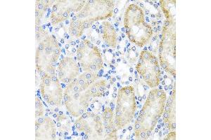 Immunohistochemistry of paraffin-embedded mouse kidney using PSTPIP1 antibody at dilution of 1:100 (x40 lens). (PSTPIP1 anticorps)