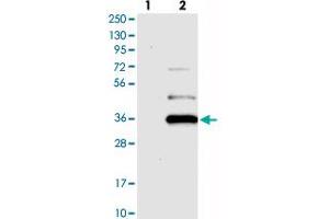 Western blot analysis of Lane 1: Negative control (vector only transfected HEK293T lysate), Lane 2: Over-expression Lysate (Co-expressed with a C-terminal myc-DDK tag (~3. (YAE1D1 anticorps)