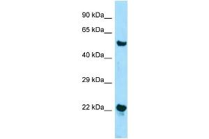 anti-Zinc Finger, DHHC-Type Containing 12 (ZDHHC12) (N-Term) antibody