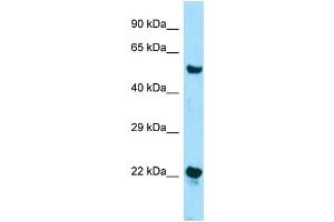 Western Blotting (WB) image for anti-Zinc Finger, DHHC-Type Containing 12 (ZDHHC12) (N-Term) antibody (ABIN2788534) (ZDHHC12 anticorps  (N-Term))