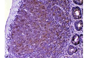 IHC analysis of CTLA4 using anti-CTLA4 antibody .