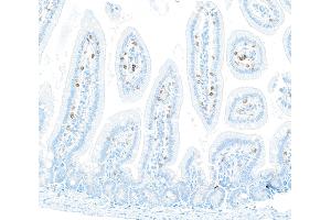 Immunohistochemistry (IHC) image for anti-CD8a Molecule (CD8A) (AA 28-194) antibody (ABIN7453877) (Recombinant CD8 alpha anticorps  (AA 28-194))