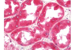 Human Kidney: Formalin-Fixed, Paraffin-Embedded (FFPE).