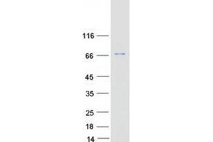 Validation with Western Blot