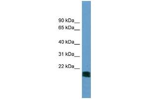 WB Suggested Anti-NT5M  Antibody Titration: 0. (NT5M anticorps  (N-Term))