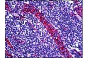 Human Tonsil, Vessel: Formalin-Fixed, Paraffin-Embedded (FFPE) (CD31 anticorps  (C-Term))